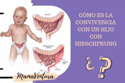 Nuestra Convivencia con un Hijo con Hirschprung | MAMAVENTURA