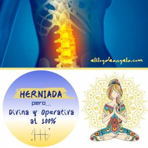 Herniada, pero Divina y Operativa al 100%