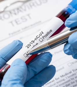 Tests para el diagnóstico de la COVID-19