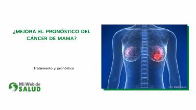 ¿Mejora El Pronóstico Del Cáncer De Mama?