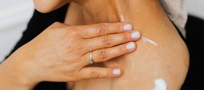 Aloe Vera para la Urticaria | ¿Funciona? - IBIZALOE