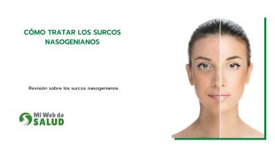 Cómo Tratar Los Surcos Nasogenianos
