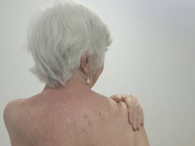 Tratamiento Hombro Congelado Sin Cirugía