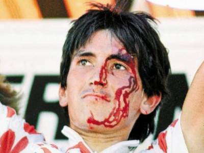 Lucho Herrera, el ícono maltratado