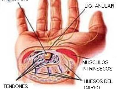 Síndrome del Túnel Carpiano: Incapacidad Temporal ¿Común o Profesional?.