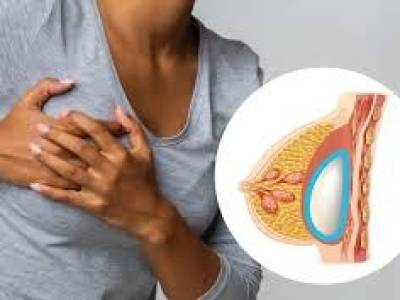 Implantes, salud y autoestima: una reflexión necesaria