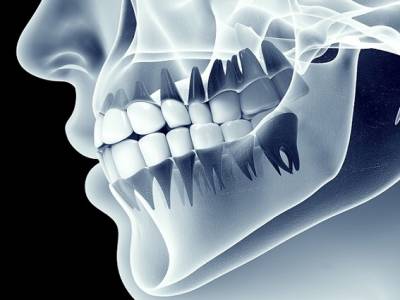 Radiografías dentales
