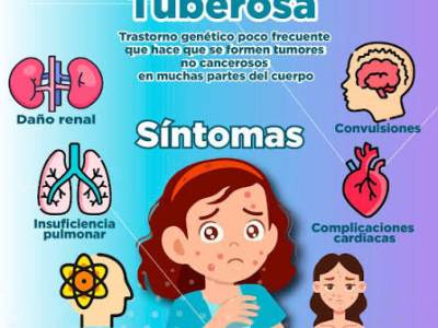 Esclerosis tuberosa: qué es, síntomas, causas y tratamiento