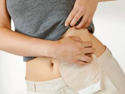 Día Mundial del Ostomizado: cuidar más allá del estoma